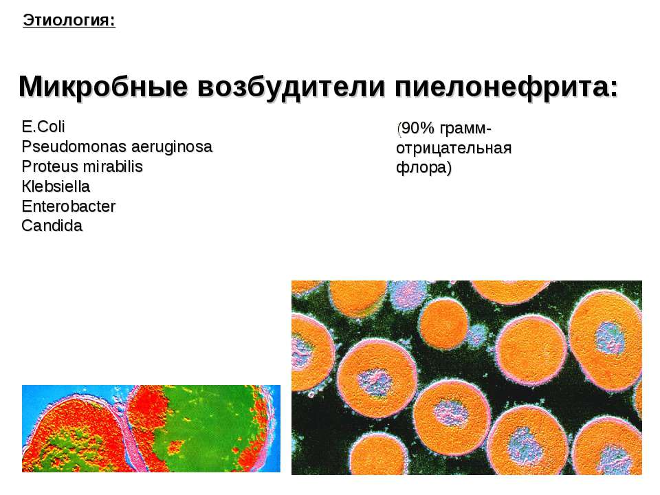 Микробные возбудители пиелонефрита