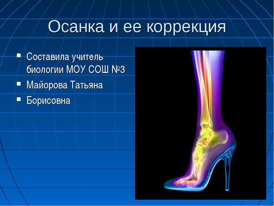 Осанка и ее коррекция