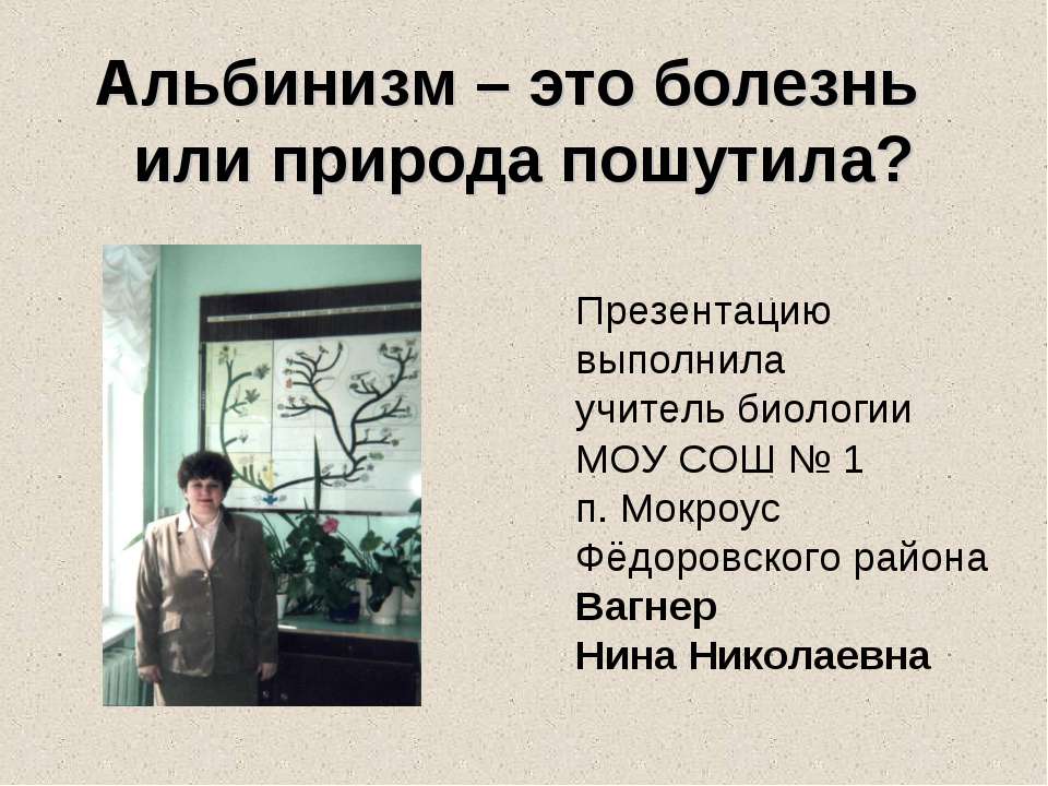 Aльбинизм – это болезнь или природа пошутила?