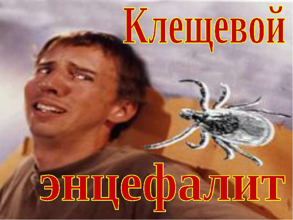 Клещевой энцефалит